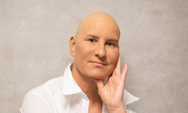 Czy chemioterapia skraca życie? Czy chemioterapia skraca życie?